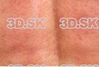 Skin texture of Gene 0004